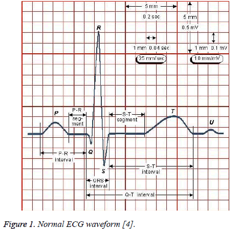 Ecg Values Chart