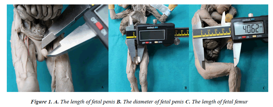 Fetal Penis 28