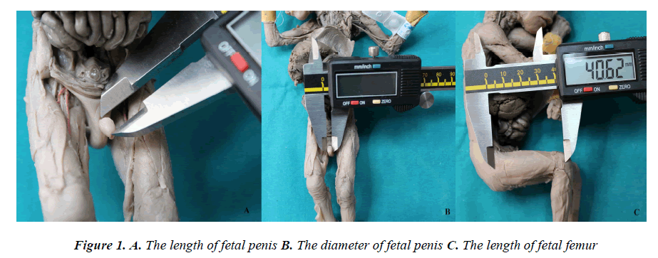 Lenght Of Penis 22