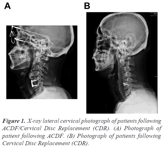 cervical