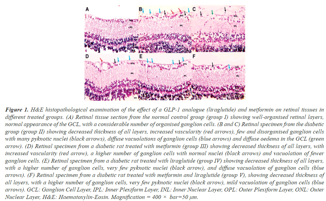 histopathological