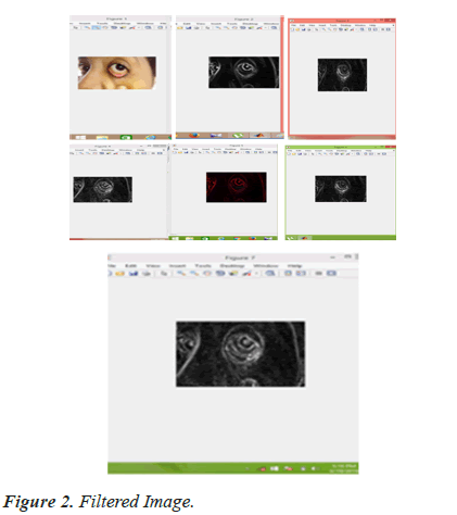 biomedres-Filtered-Image