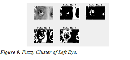 biomedres-Left-Eye