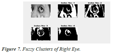 biomedres-Right-Eye