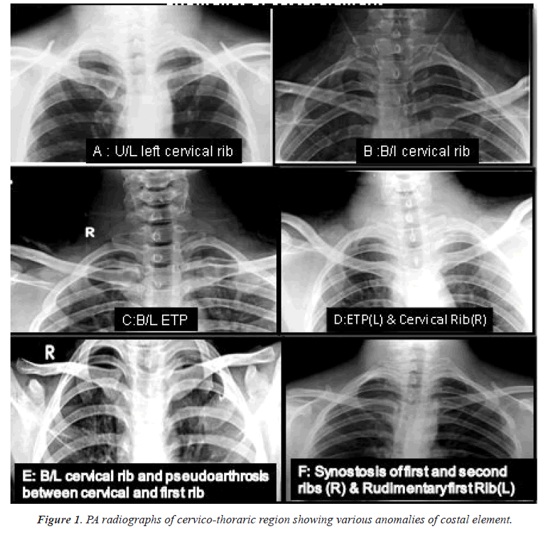 biomedres-cervico-thoraric