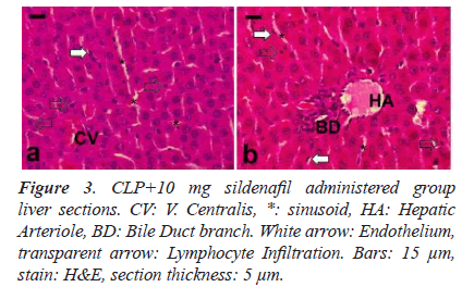 biomedres-sildenafil