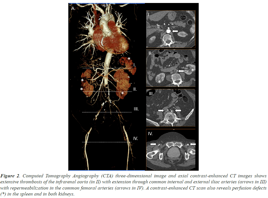 Angiography