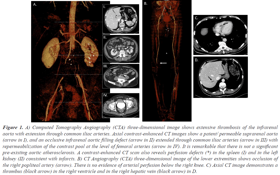 Tomography