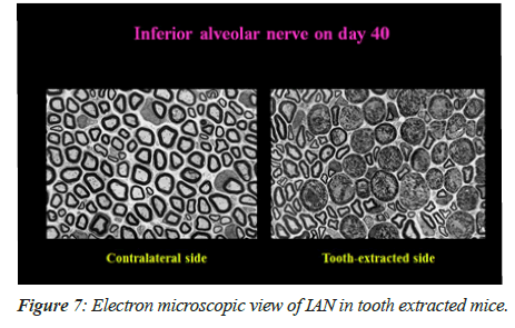 Electron