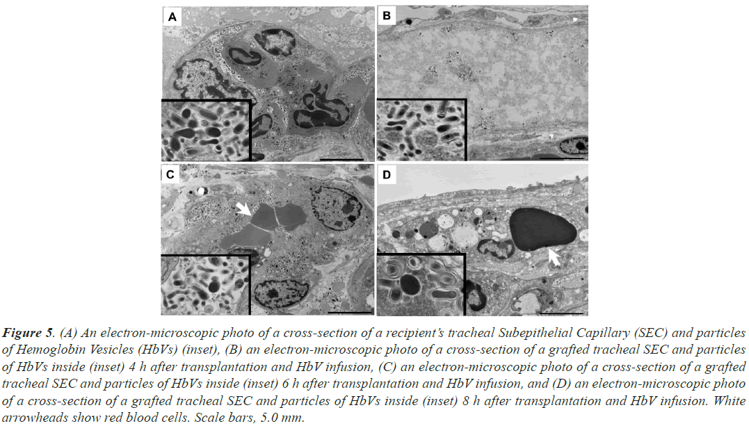 Subepithelial