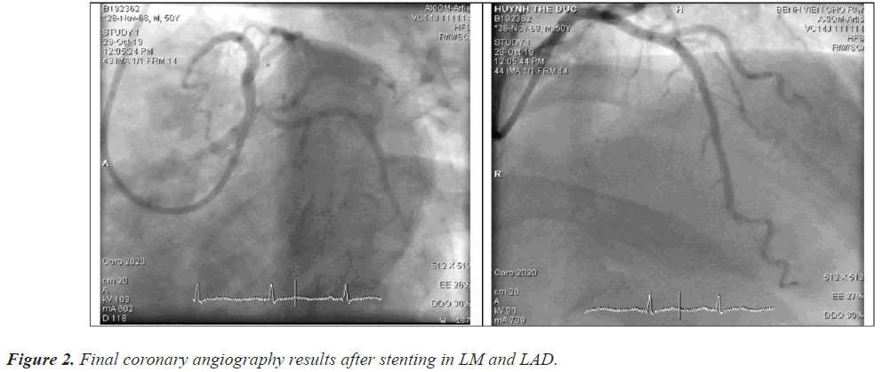 angiography