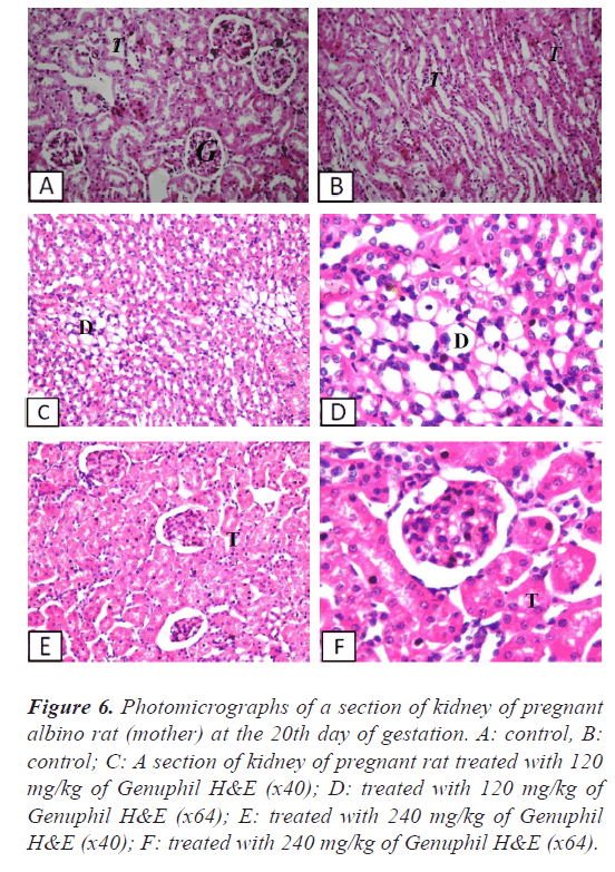 kidney