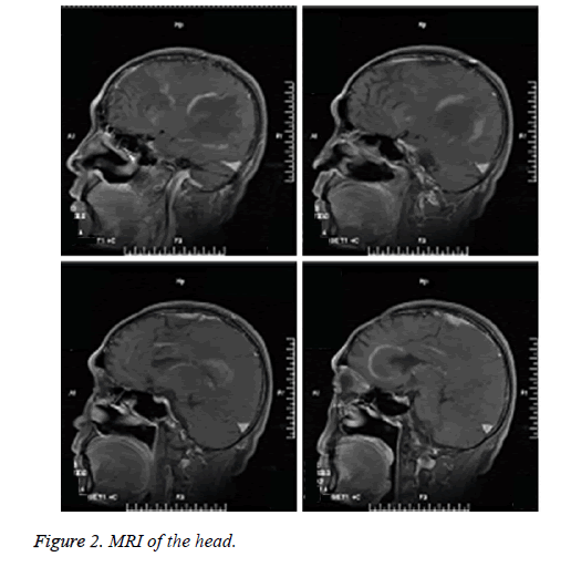 biomedical-research-MRI