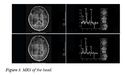 biomedical-research-MRI-head