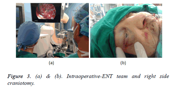 biomedical-research-craniotomy