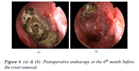 biomedical-research-endoscopy