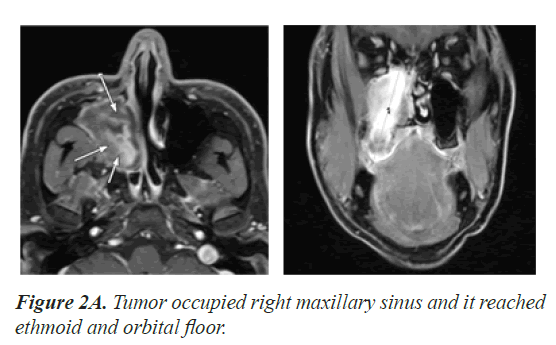 biomedical-research-ethmoid