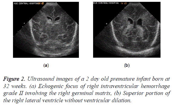 biomedical-research-intrаventriculаr