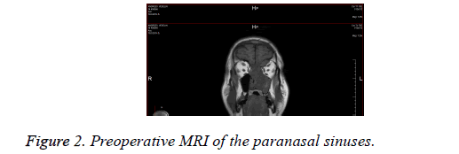 biomedical-research-paranasal