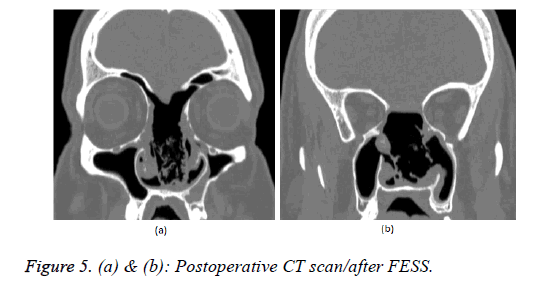 biomedical-research-postoperative