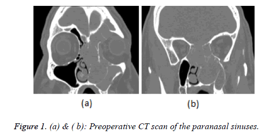 biomedical-research-preoperative