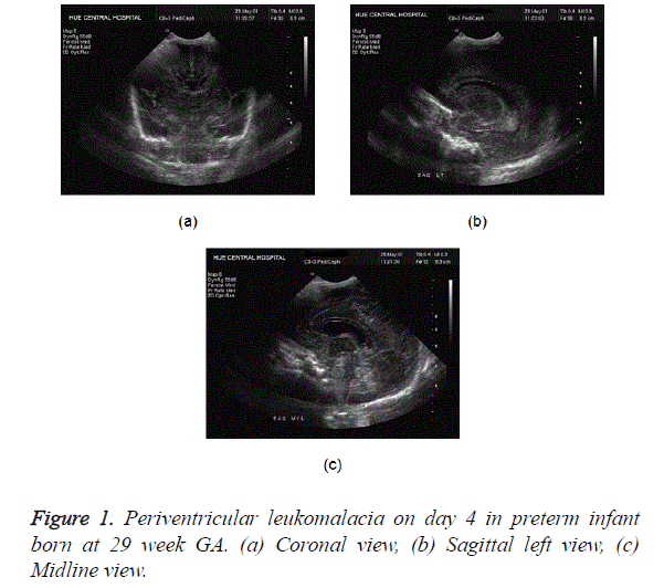 biomedical-research-preterm-infаnt