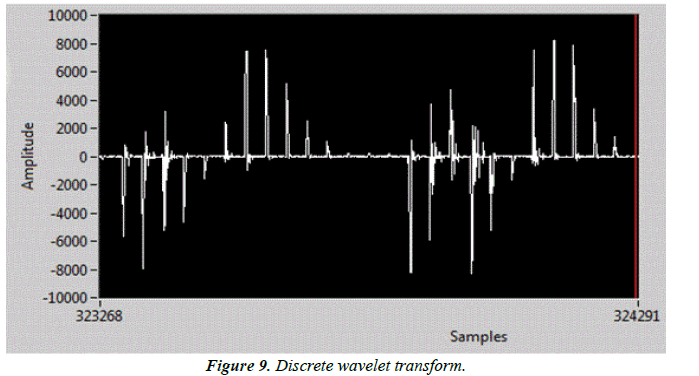 biomedical-research-wavelet