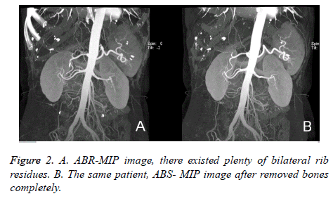 biomedres-ABR-MIP-image