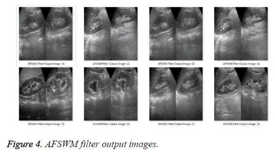 biomedres-AFSWM-filter