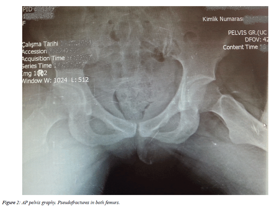 biomedres-AP-pelvis