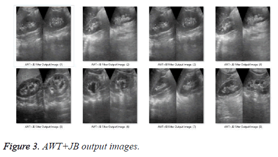 biomedres-AWT-JB-output