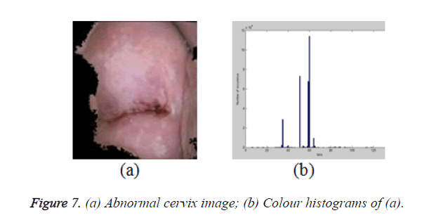 biomedres-Abnormal-cervix