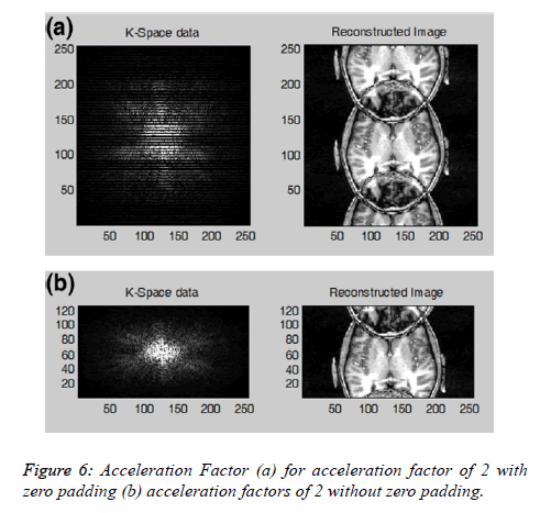 biomedres-Acceleration-Factor