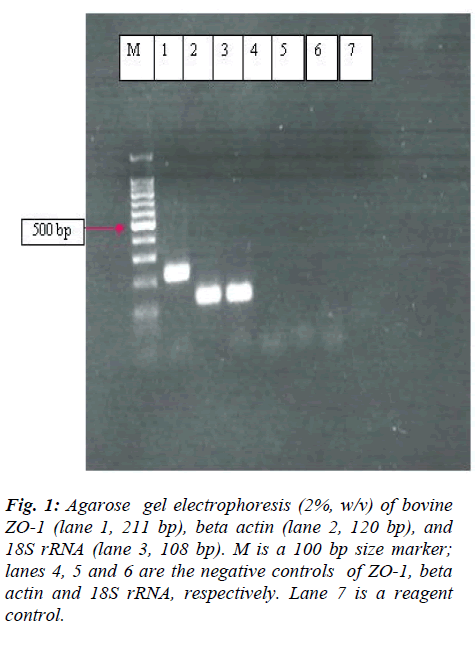 biomedres-Agarose-gel-electrophoresis