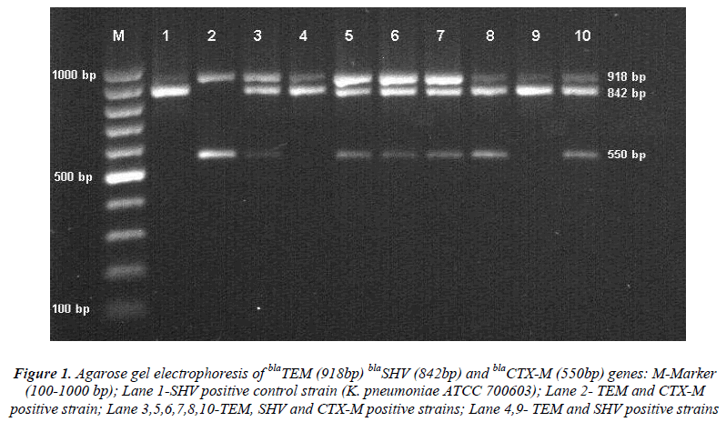 biomedres-Agarose-gel-electrophoresis-positive