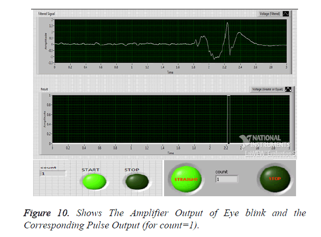 biomedres-Amplifier-Output