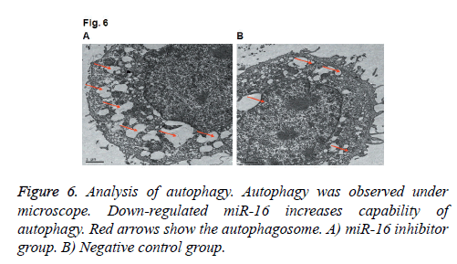 biomedres-Analysis-autophagy