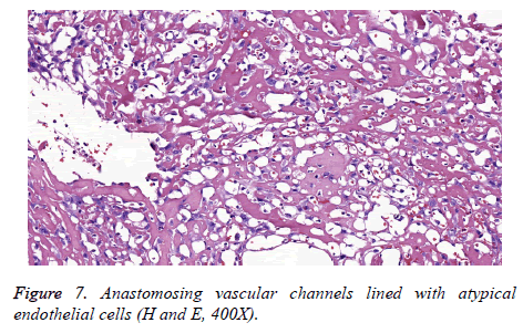 biomedres-Anastomosing-vascular