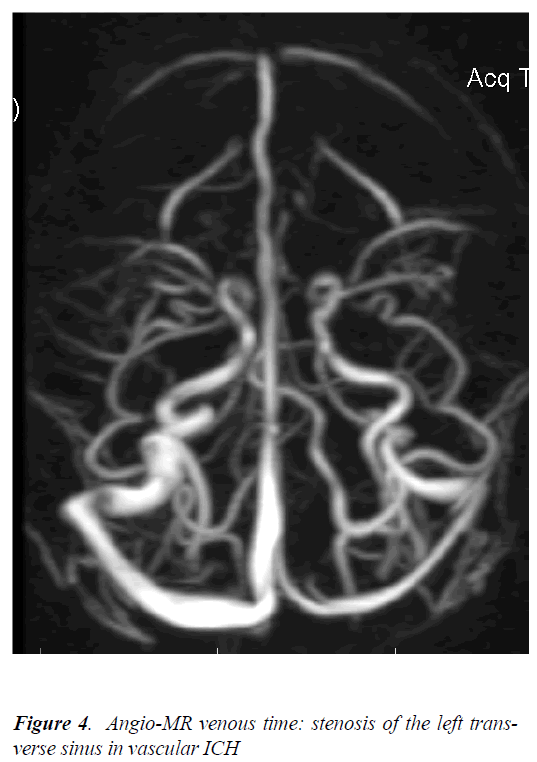 biomedres-Angio-MR-venous