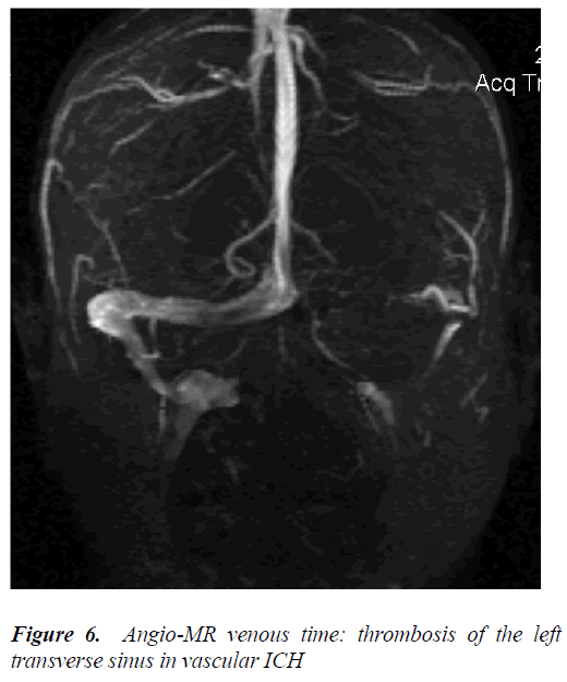 biomedres-Angio-MR-venous