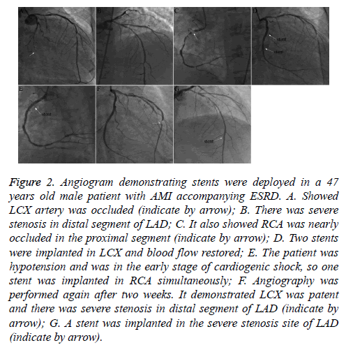 biomedres-Angiogram-demonstrating