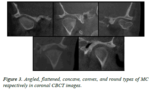 biomedres-Angled-flattened-concave