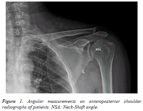 biomedres-Angular-measurements