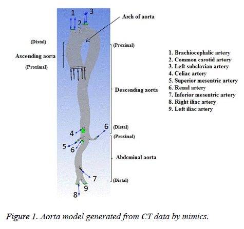 biomedres-Aorta-model