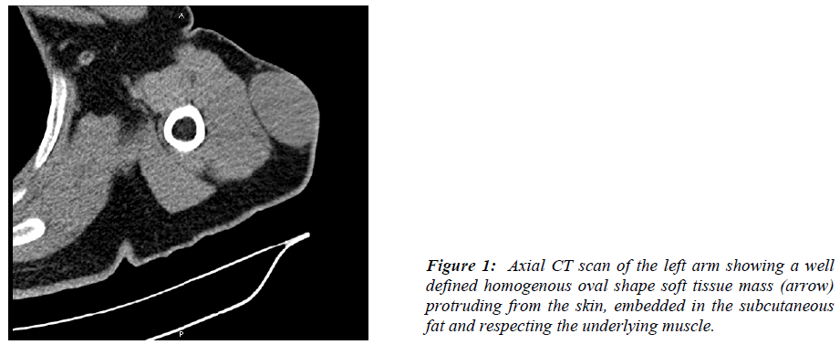 biomedres-Axial-CT-scan