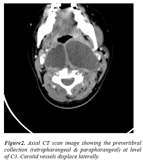 biomedres-Axial-CT-scan-image