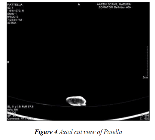 biomedres-Axial-cut-view-Patella