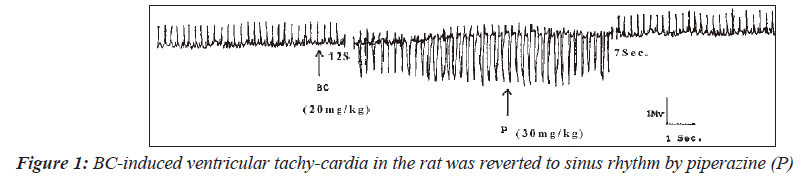 biomedres-BC-induced-ventricular-tachy-cardia