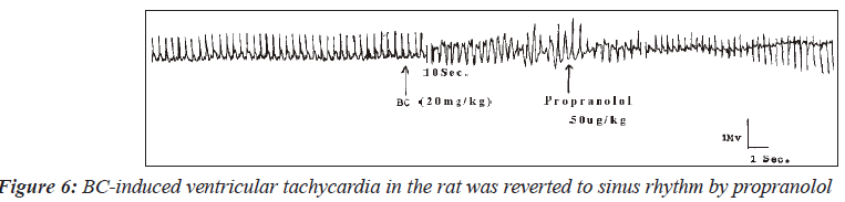 biomedres-BC-induced-ventricular-tachycardia