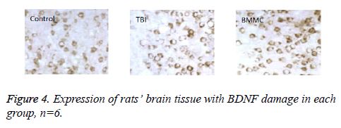 biomedres-BDNF-damage